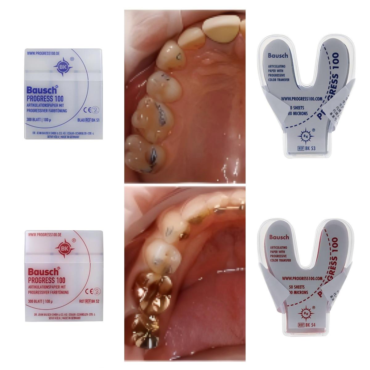 Bausch BK51 BK52 BK53 BK54 Den - огляд і ціна Bite Indicator